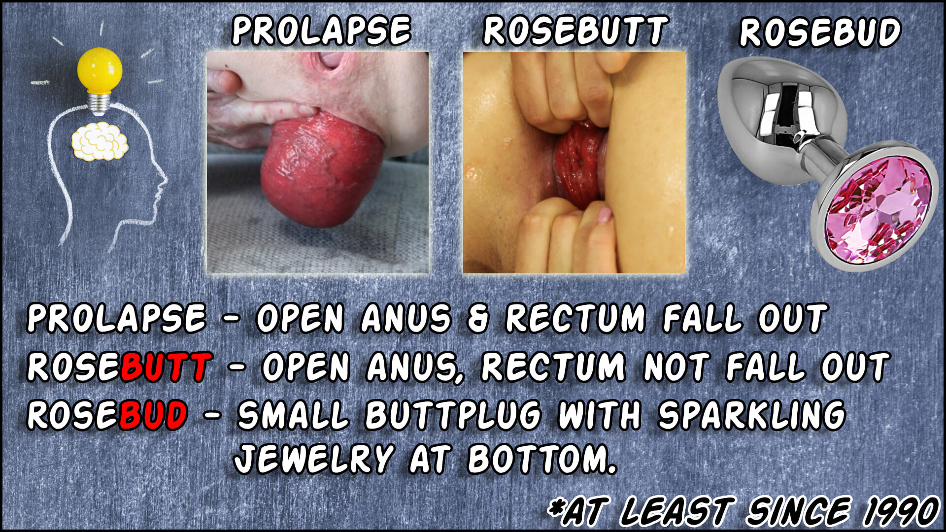 rosebutt and prolapse ARE NOT rosebud.