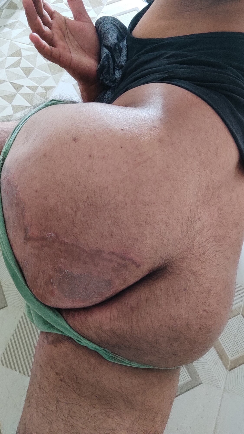 My Ass  #13