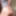 anal dilation after big insertion
