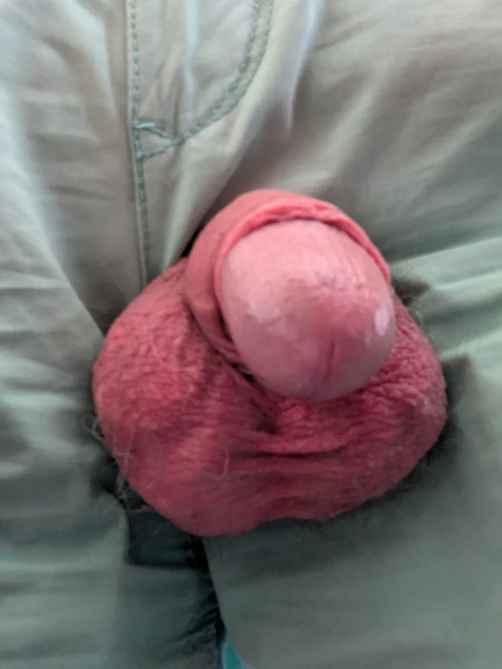 pants torn #6