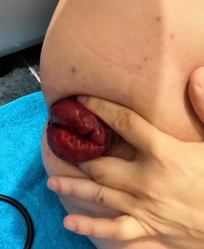 extreme prolapse pumping #10