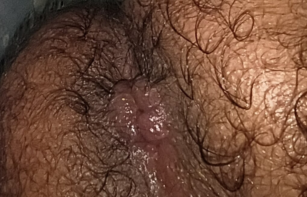 Me ass and fuck