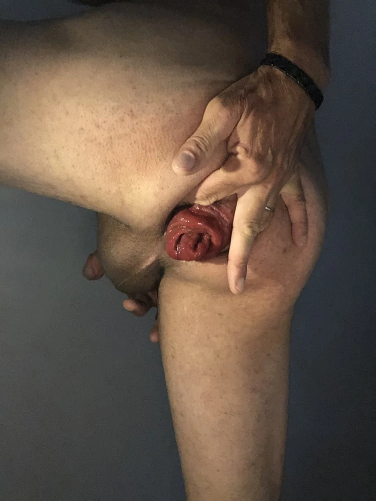 my anal prolapse is changing incredibly #31