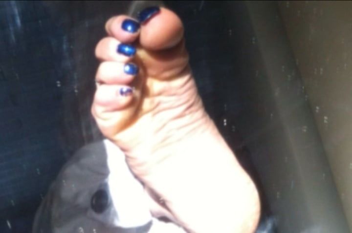 Blue toenails under sun ray #29