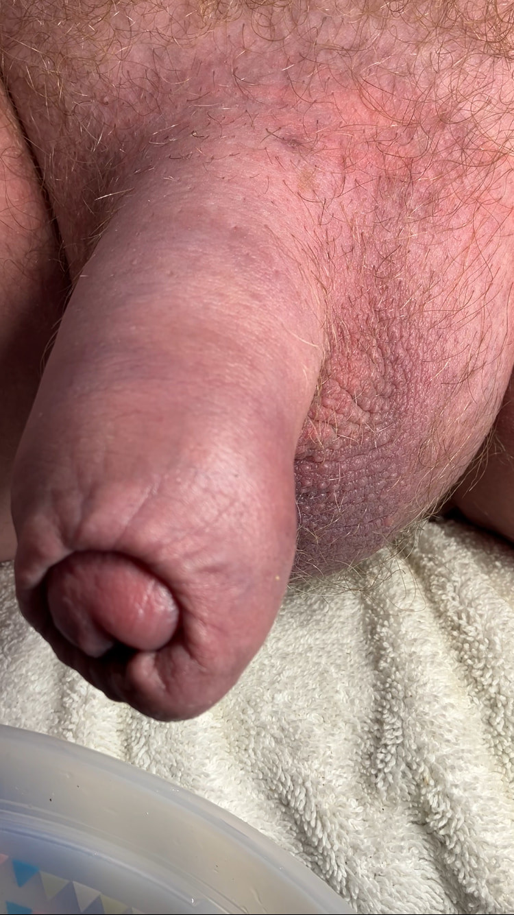 Compilation of uncut cock pics #12