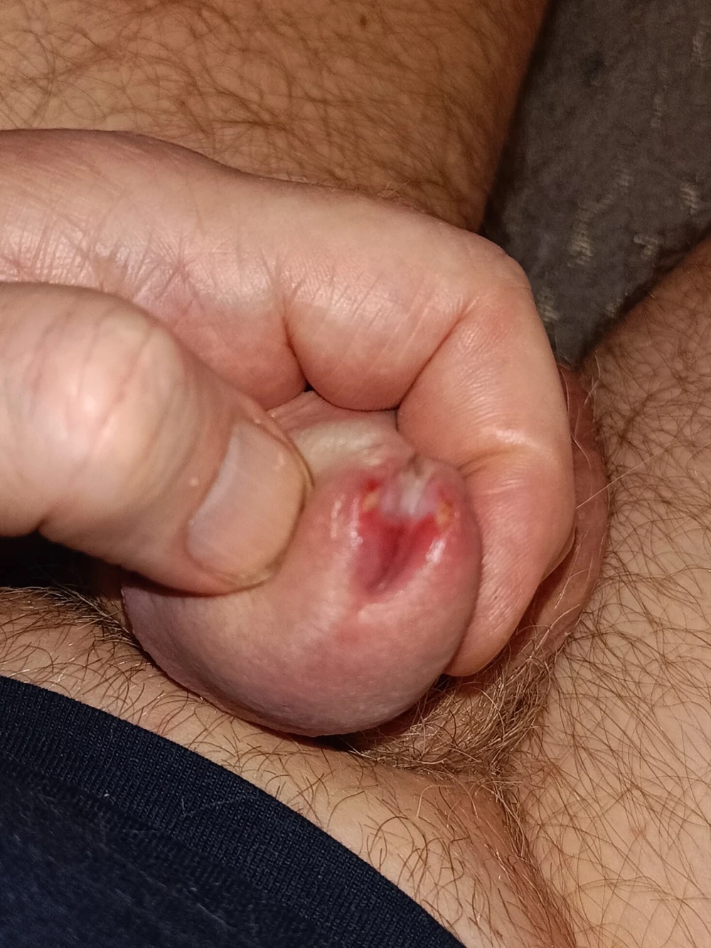 penis podzielony #6