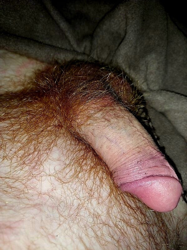 Fire bush #17