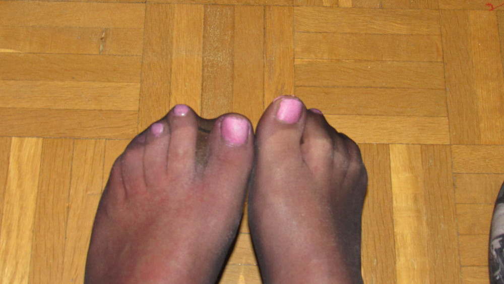feet #2