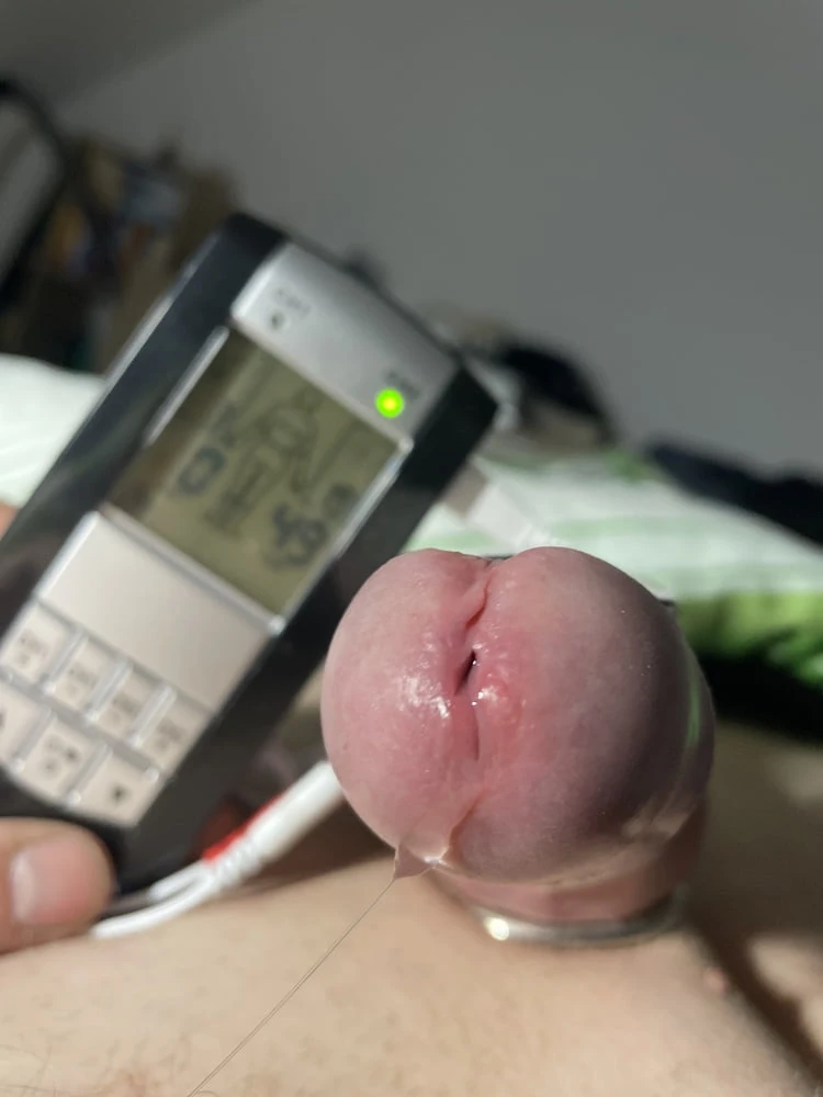 E-stim #25