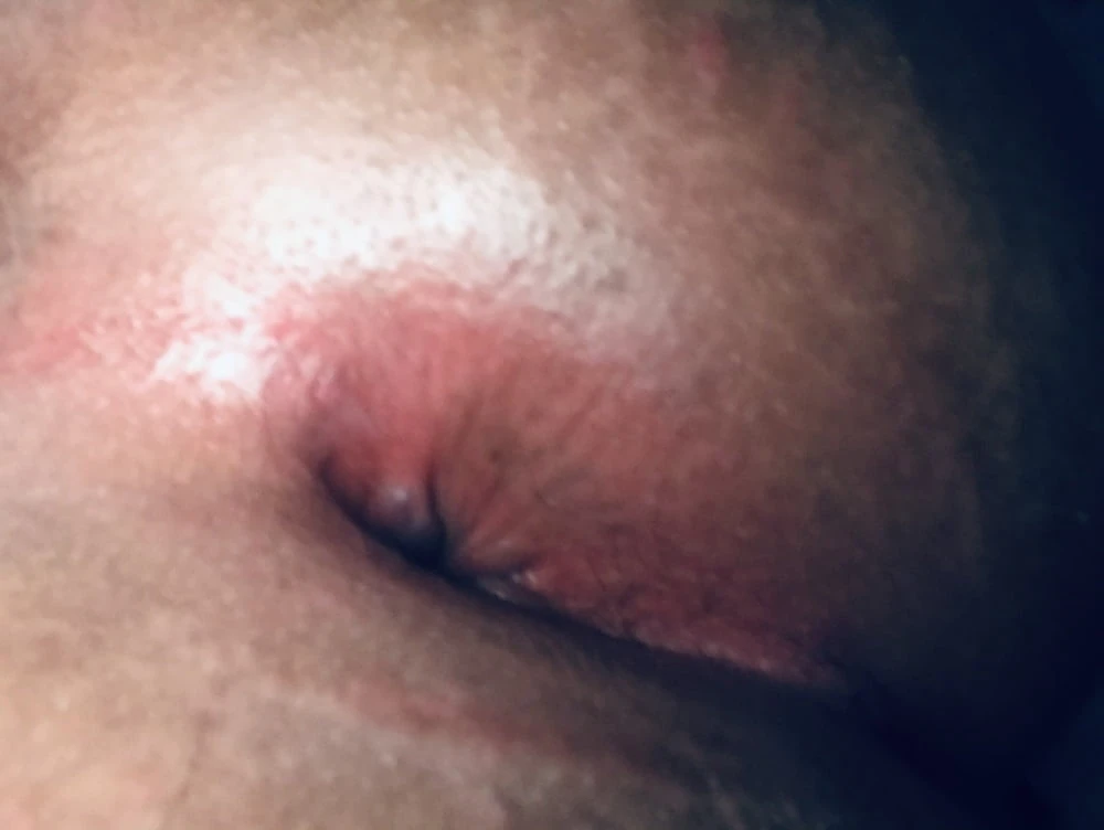 My Pinky-Red Juicy asshole #4