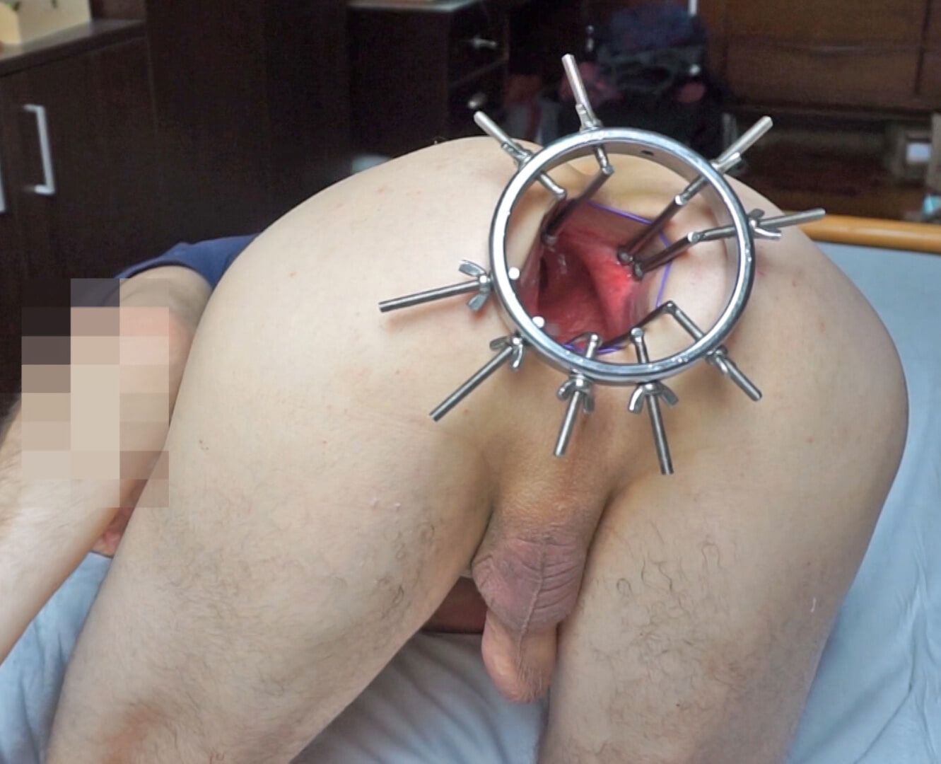 Mega anal spreader! #21