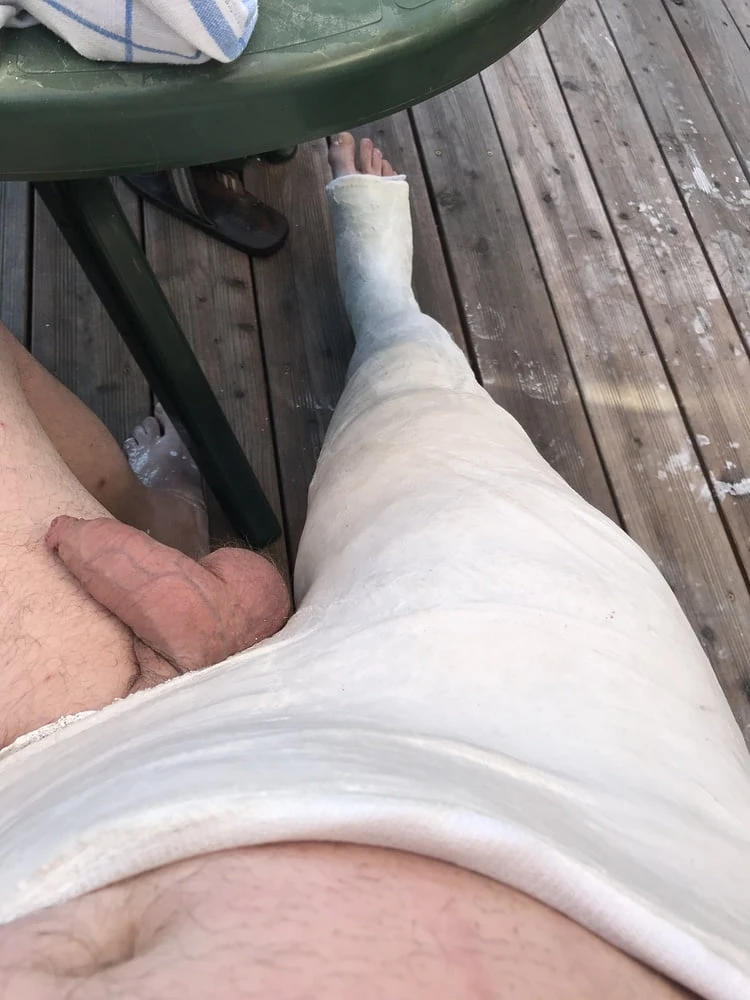 Bodycast #3