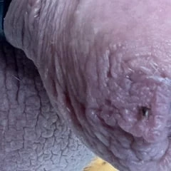 Zwei Zecken machen es sich heimisch an meinem Schwanz