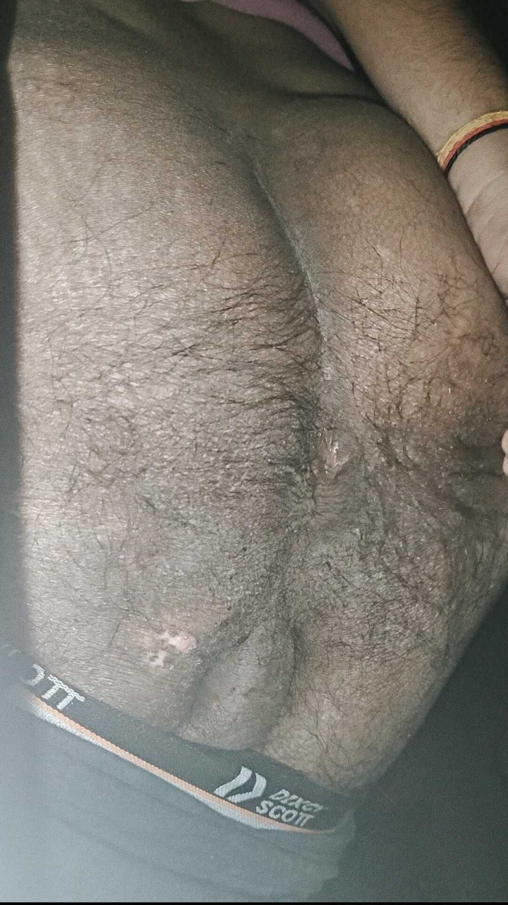 My friend asshole  #8