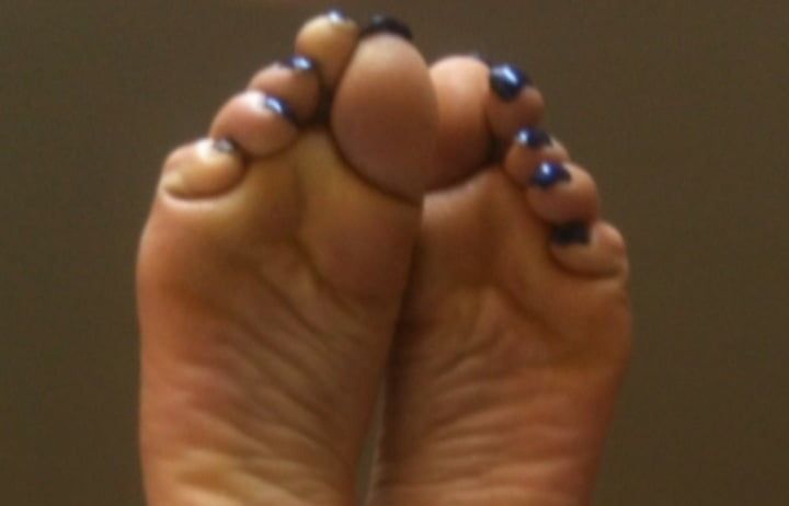 blue toenails and soles feet after day at beach  #35