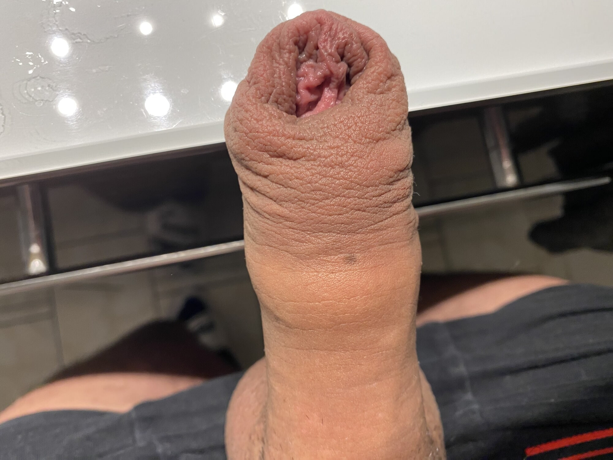 Foreskin after extreme stretching porn