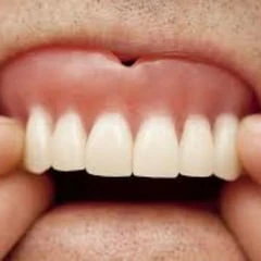 My sexy dentures