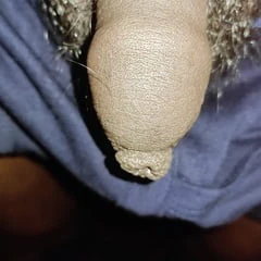 Indian Kunju