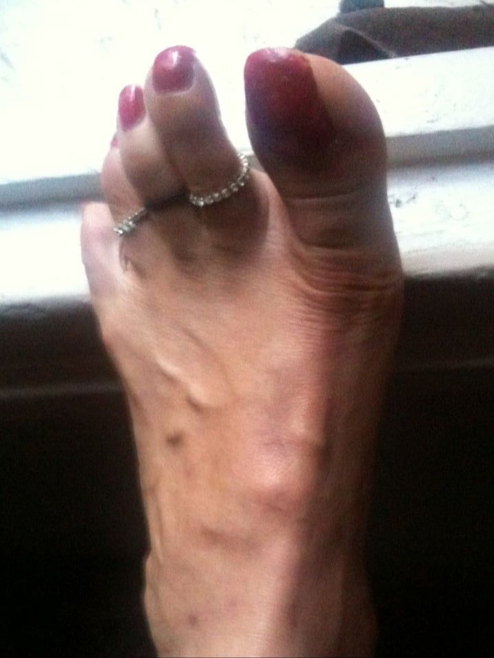 red toenails mix (older, dirty, toe ring, sandals mixed). #36