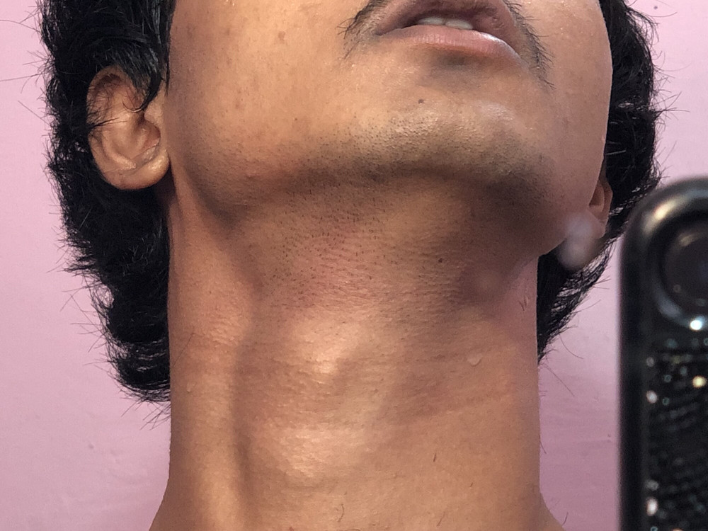 Pics of my slim  body  #21