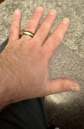 الشرج يدي ستيف وقدميه