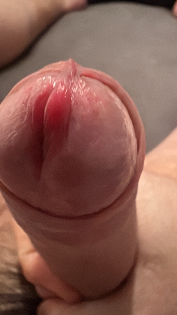 Dick
