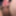 Fingering subincision deep #8
