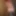Symbolism: huge Analdream and female Hair
