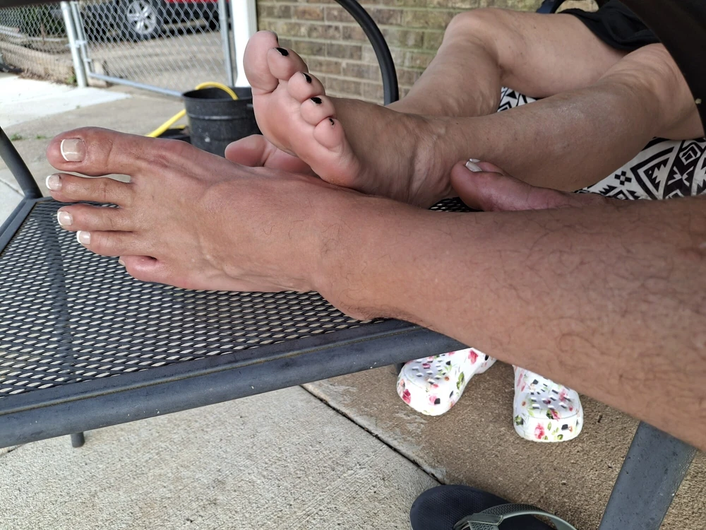 Foot comparison #35
