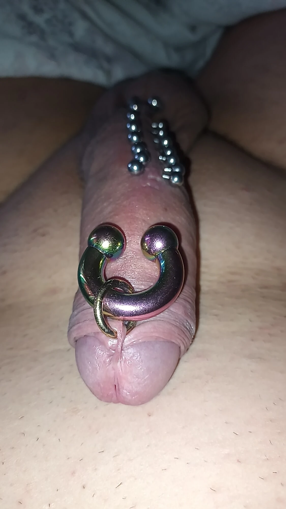 Fisting anale
