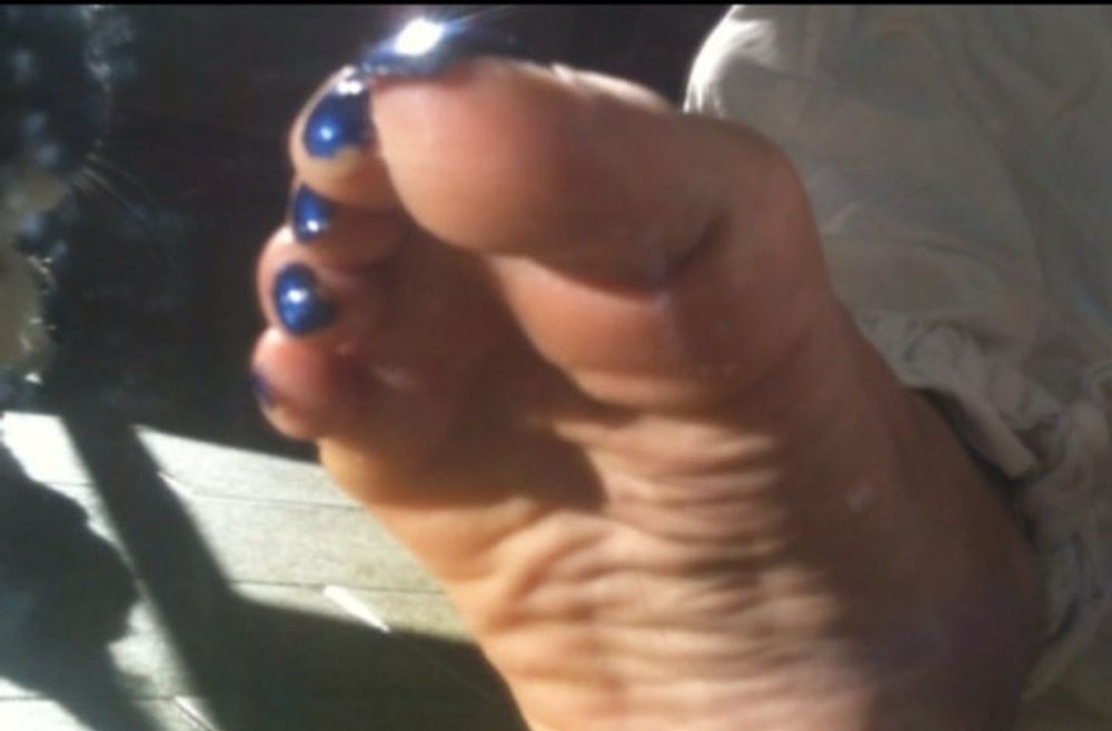 Blue toenails under sun ray #7