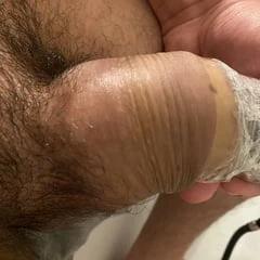 Foreskin extreme stretching