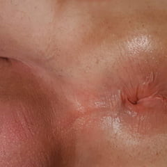 My hole