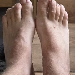 My feet