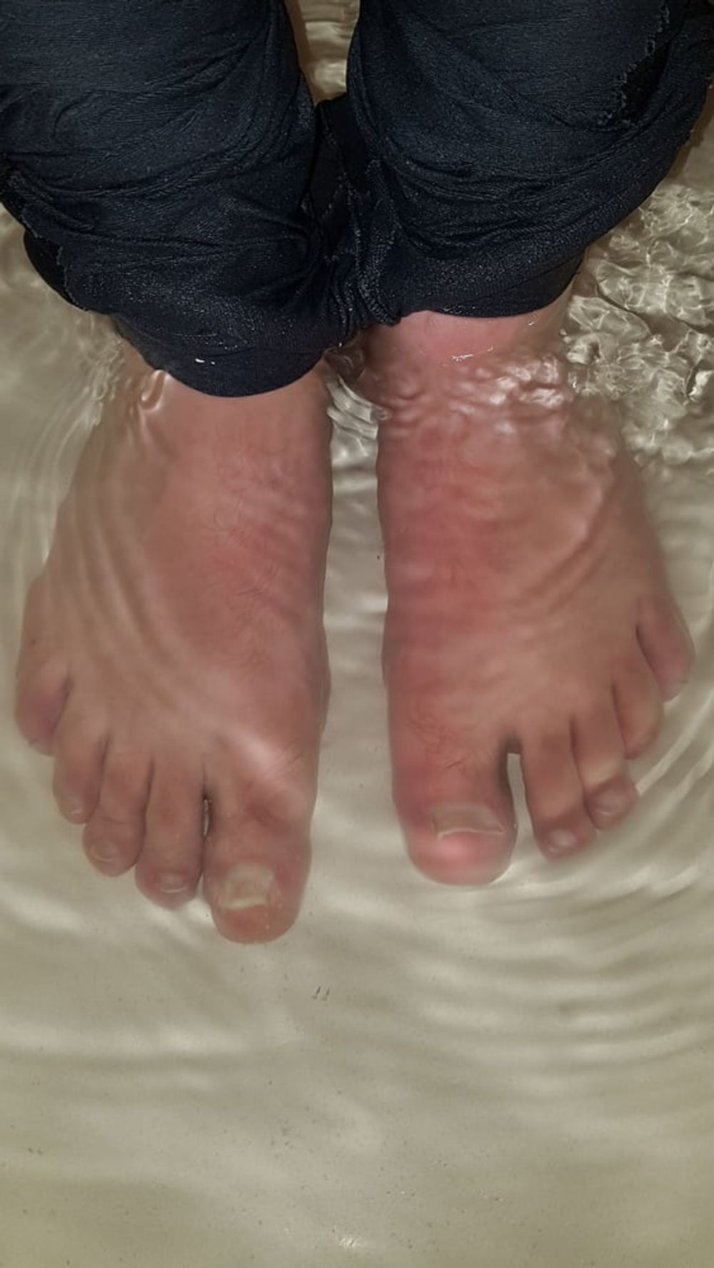 My bare feet (request) #2