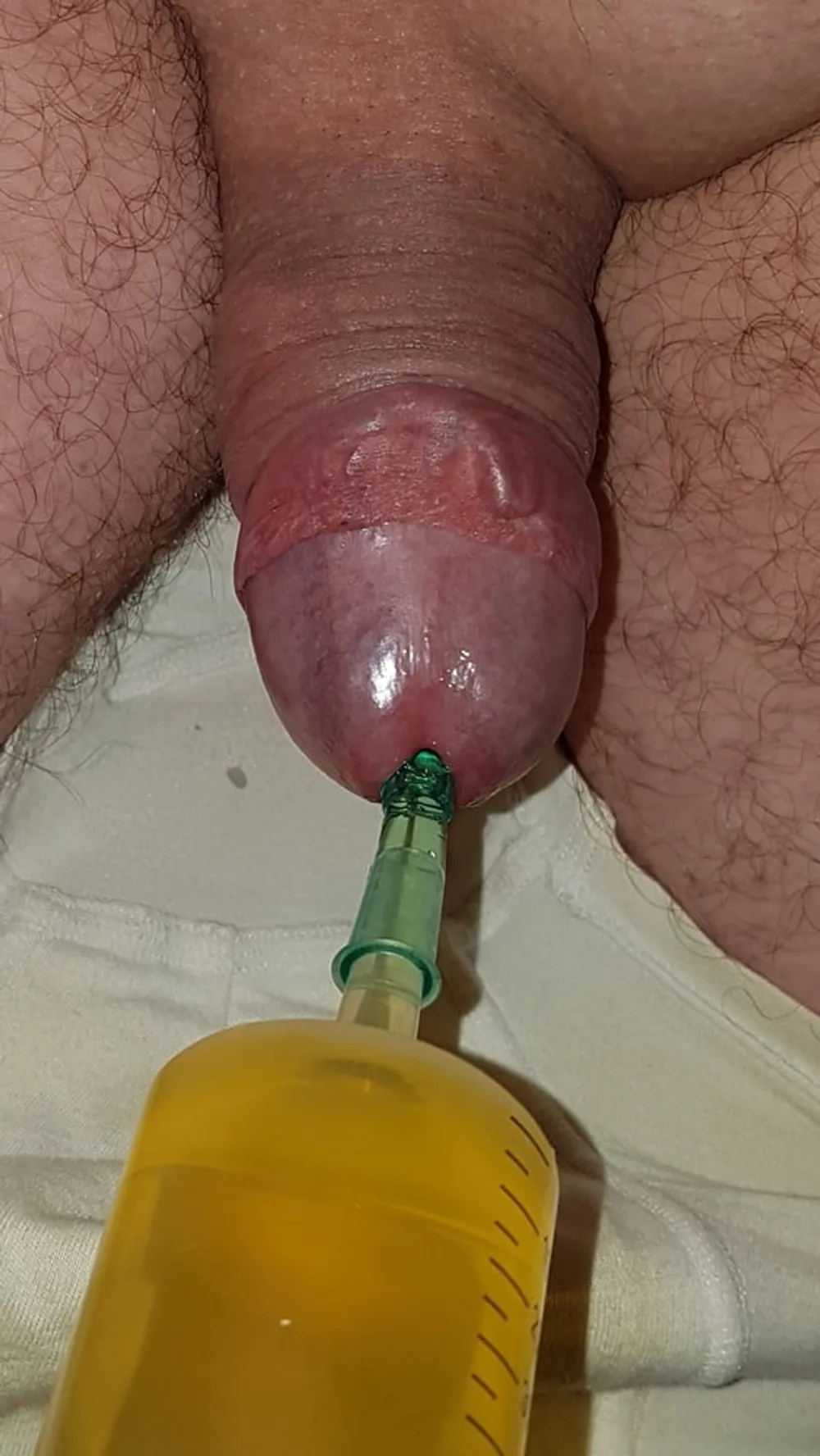 Catheter sounding with my urine #35