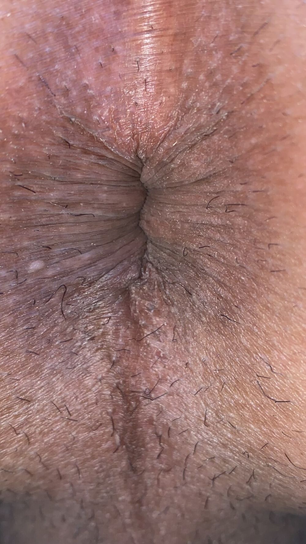 Close-up of a man&#039;s anus #18