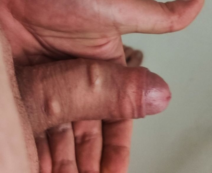 Ich 