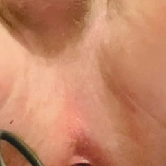 Gaping my asshole