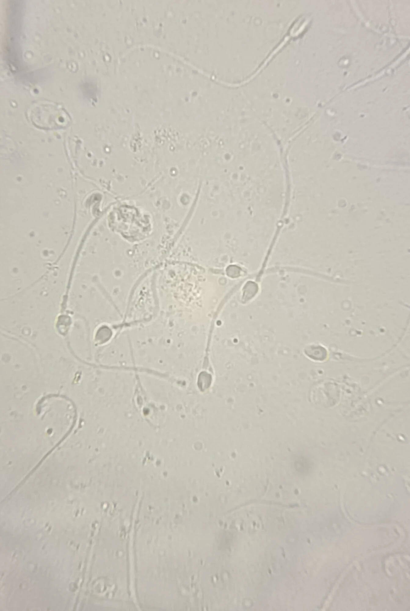 My live sperm