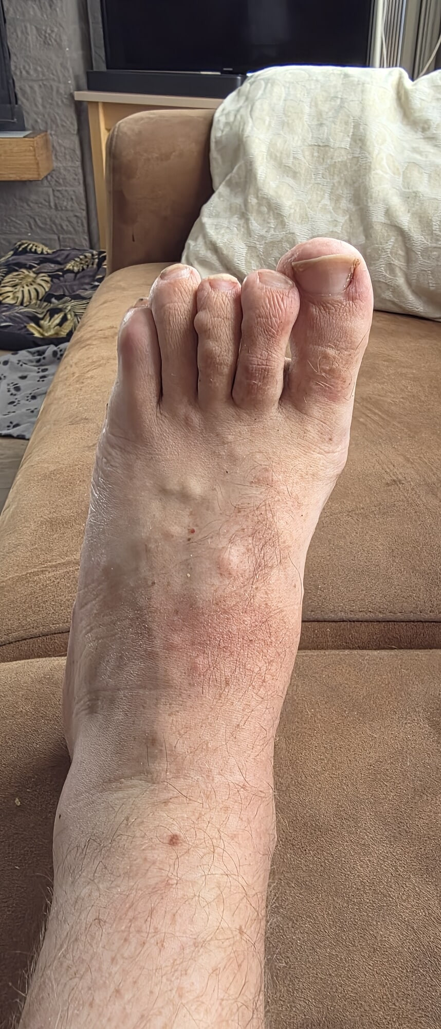My feet #4