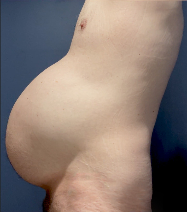 Ximd9000 Big Bloated Belly #23