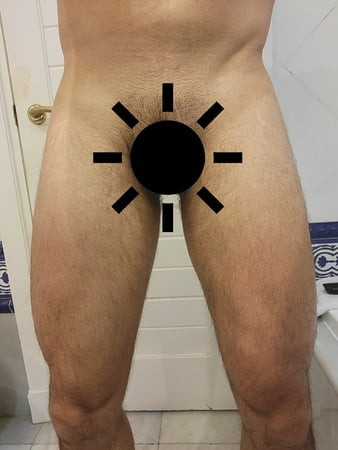 NX2