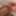 Foreskin hard stretching porn
