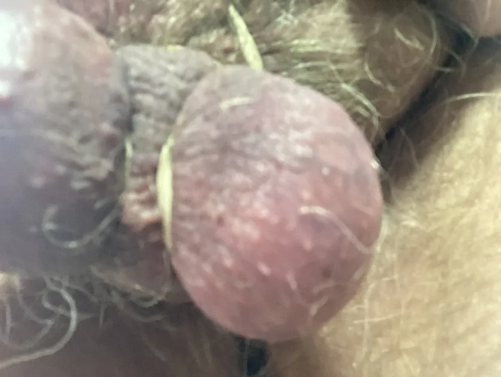 More tortured purple balls #6