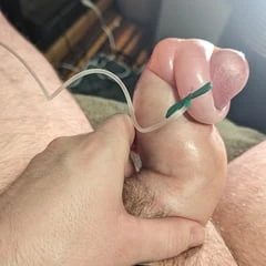 Saline Foreskin