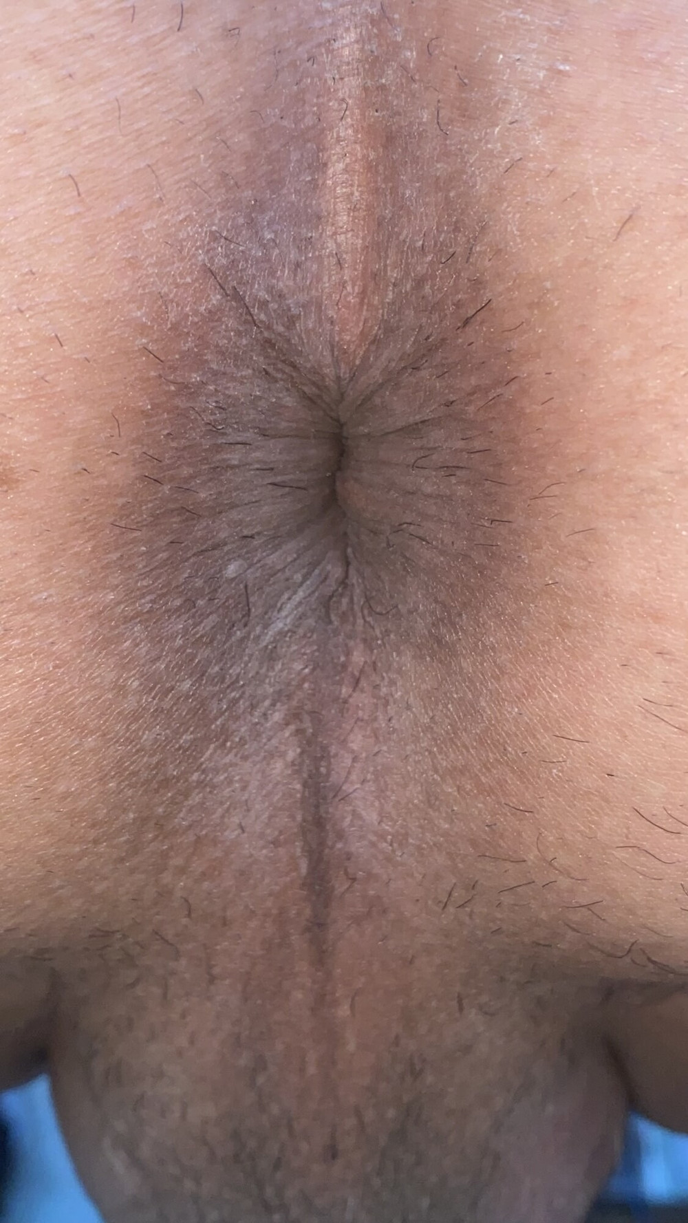 Close-up of a man&#039;s anus #53
