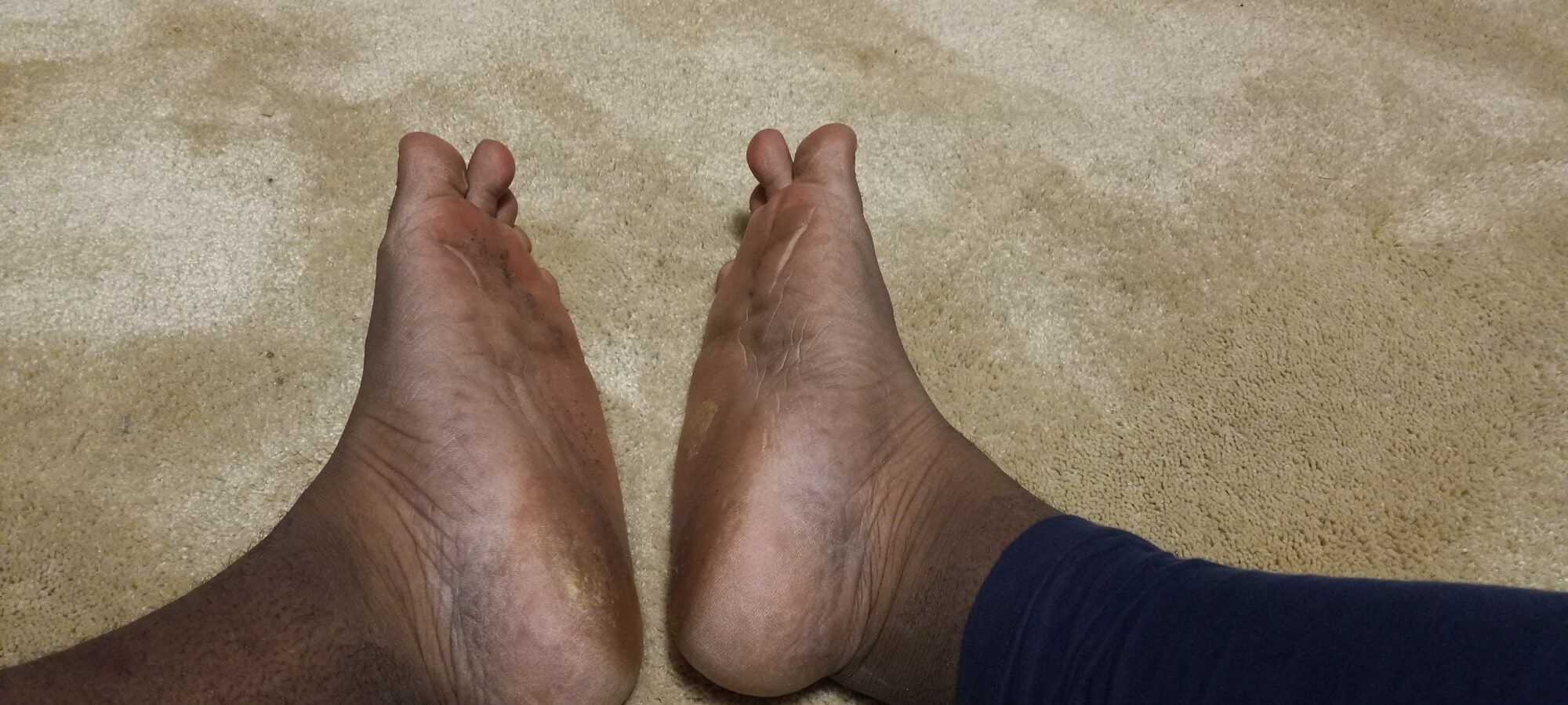 Pics of my Feet #21