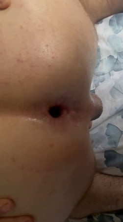 my fresh hole