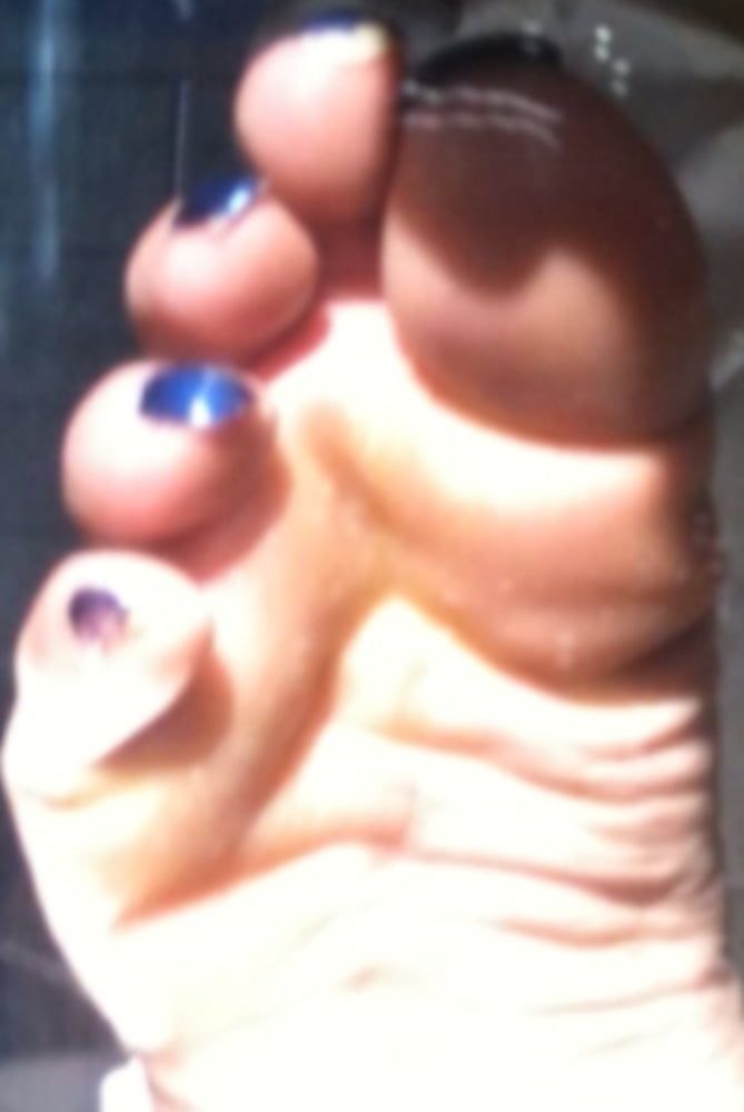 Blue toenails under sun ray #26